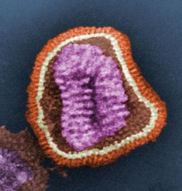 electron micrograph of a flu virus in cross section